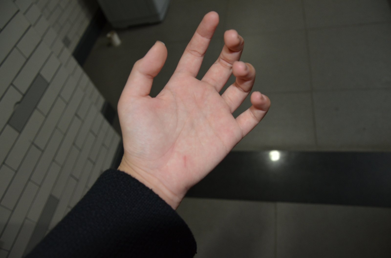 手被划伤